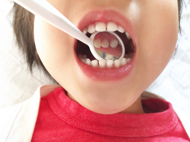 子供の虫歯は遺伝？