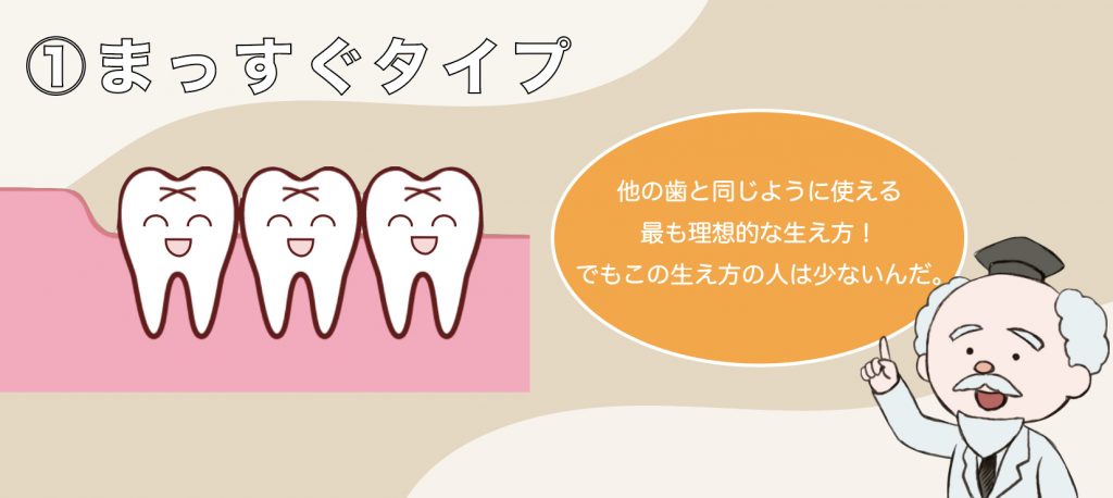 親知らず　まっすぐ生えている